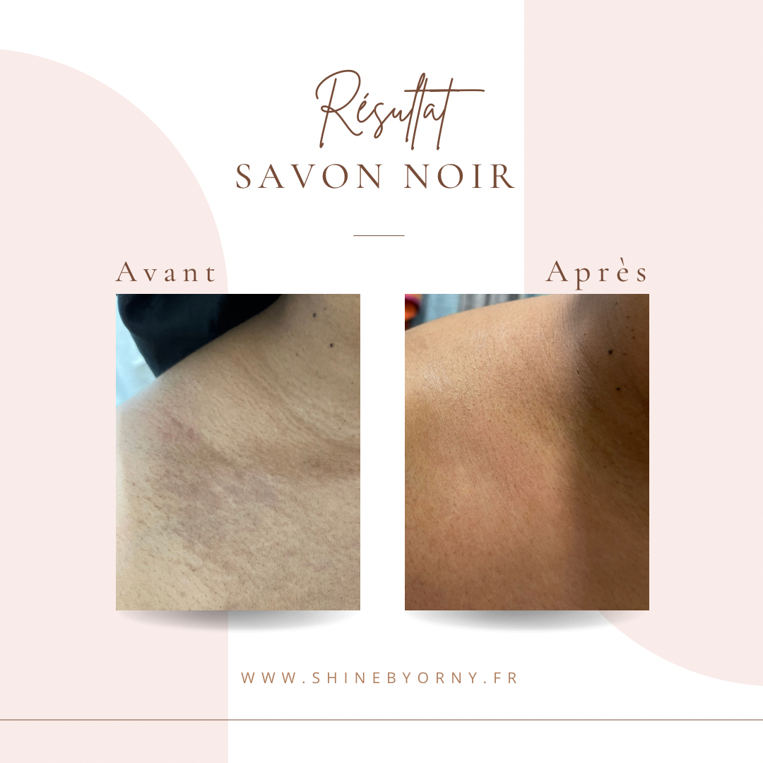 Le savon Noir