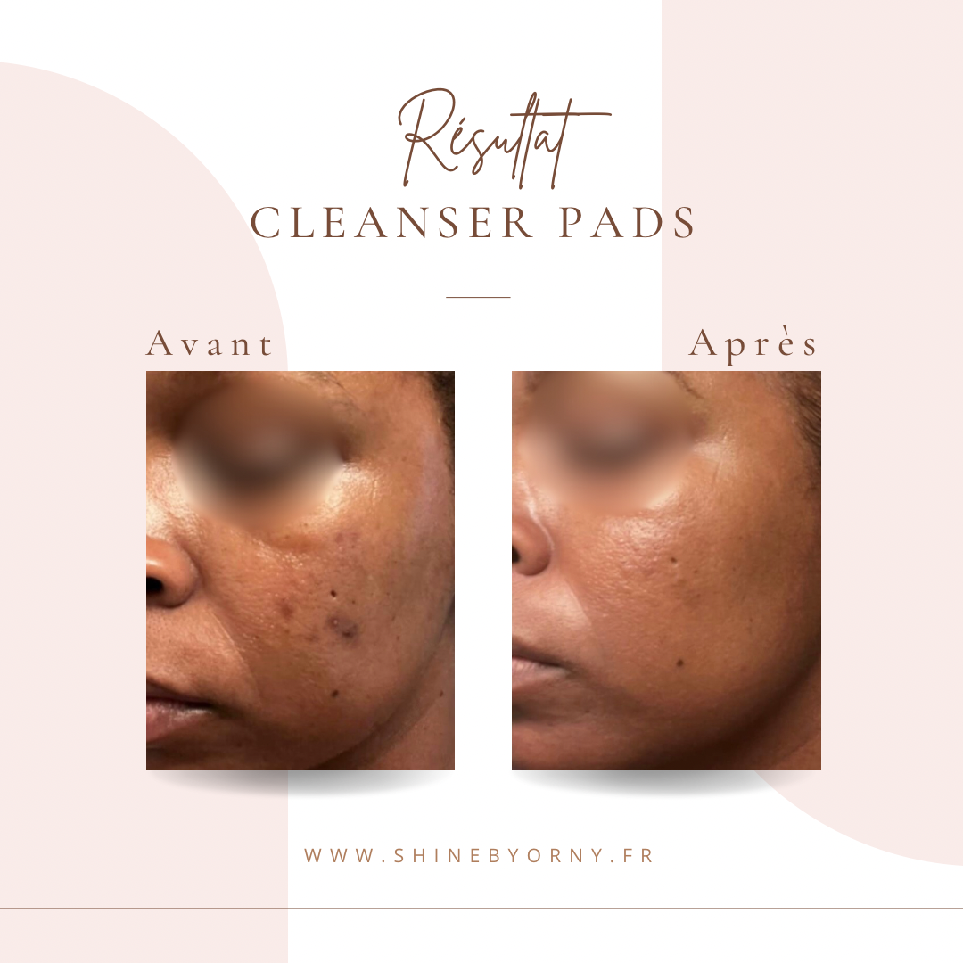 Cleanser pad Curcuma et Acide Kojic